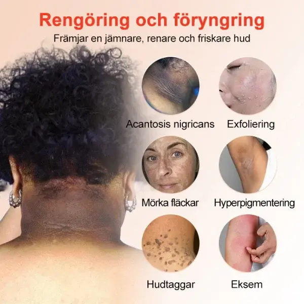 Purifying Peeling Gel - Image 7
