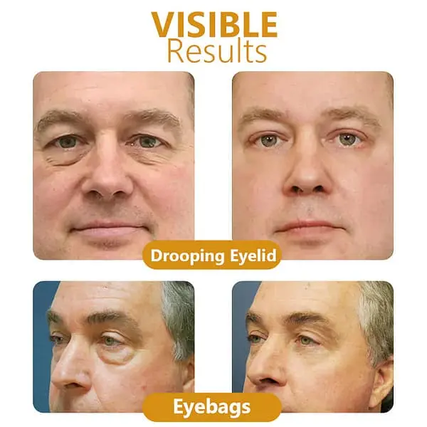 Bee Venom Awakening Peptide Eye Lifting Gel - Image 7