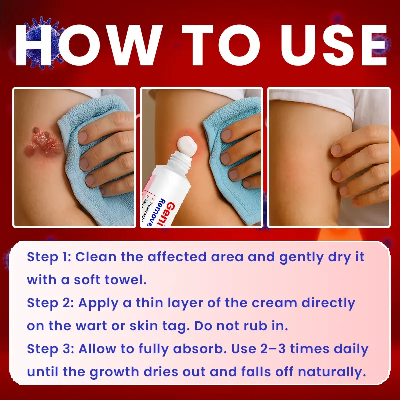 Genital Warts Remover Cream - Image 11