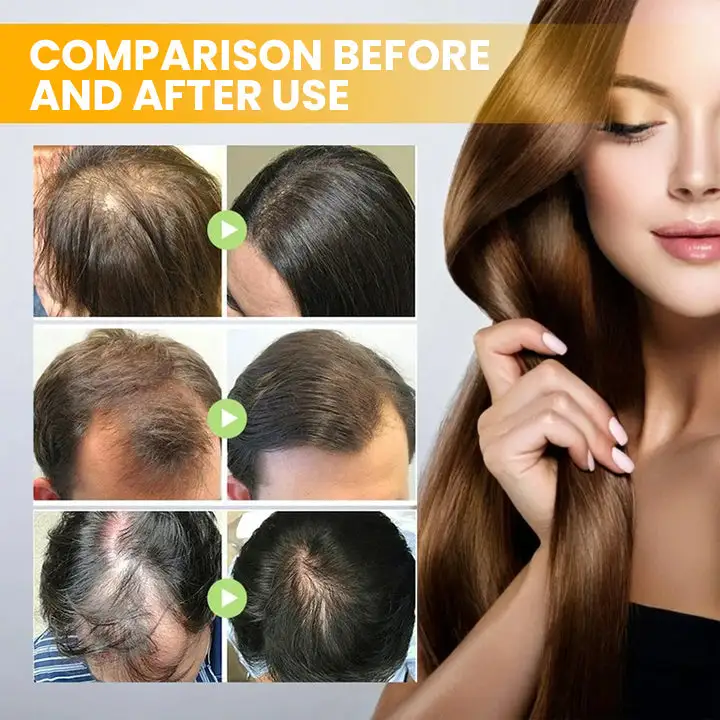 Spray-on Hair Growth Essence - Image 9
