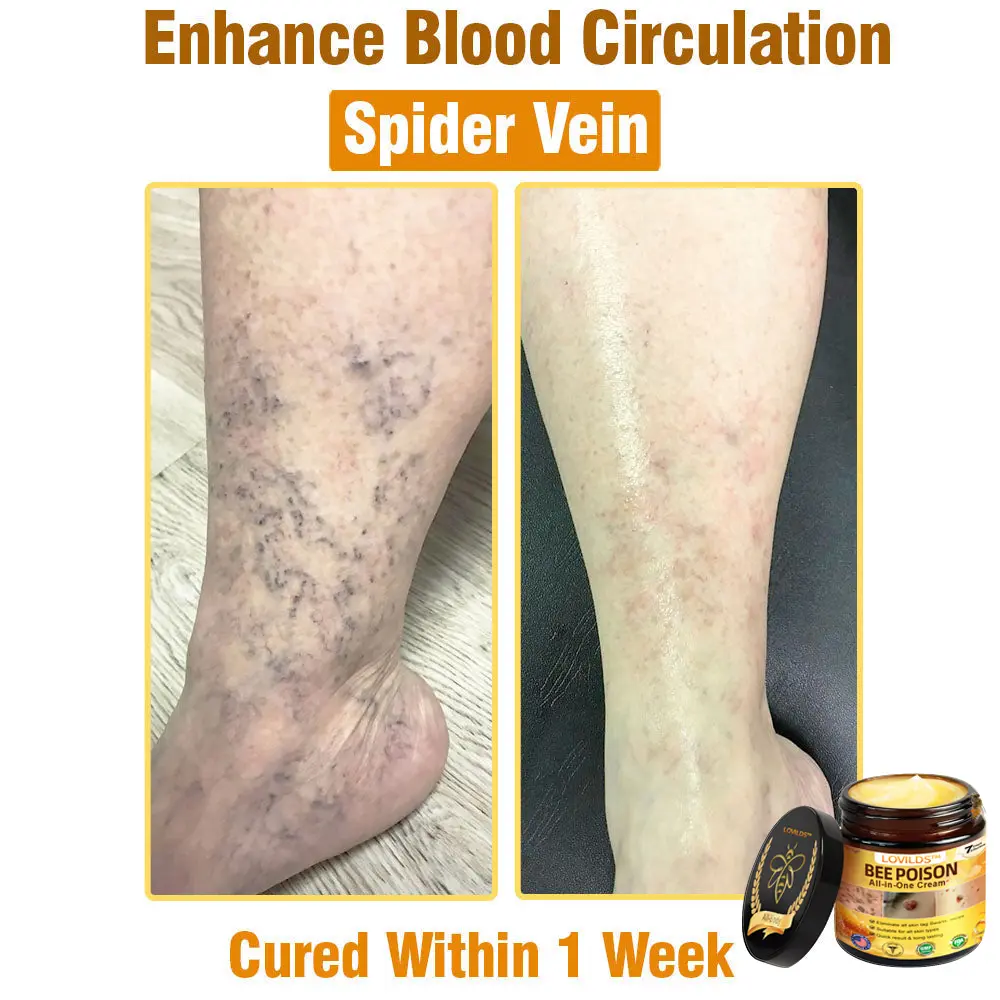 Bee Poison All-in-One Cream US Dermatologist Approved - Image 2