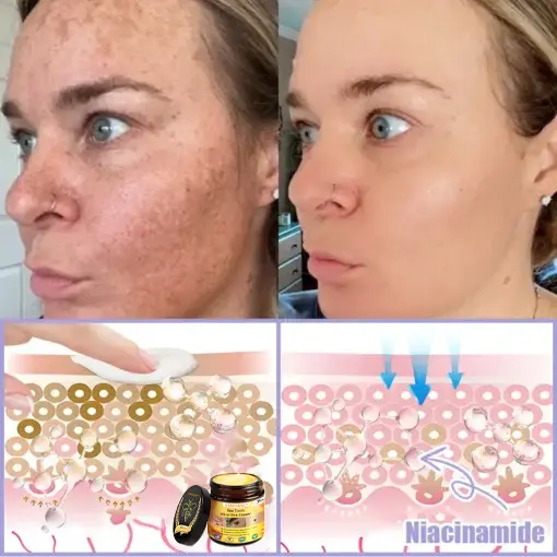 Bee Toxin Lift Cream - Image 8