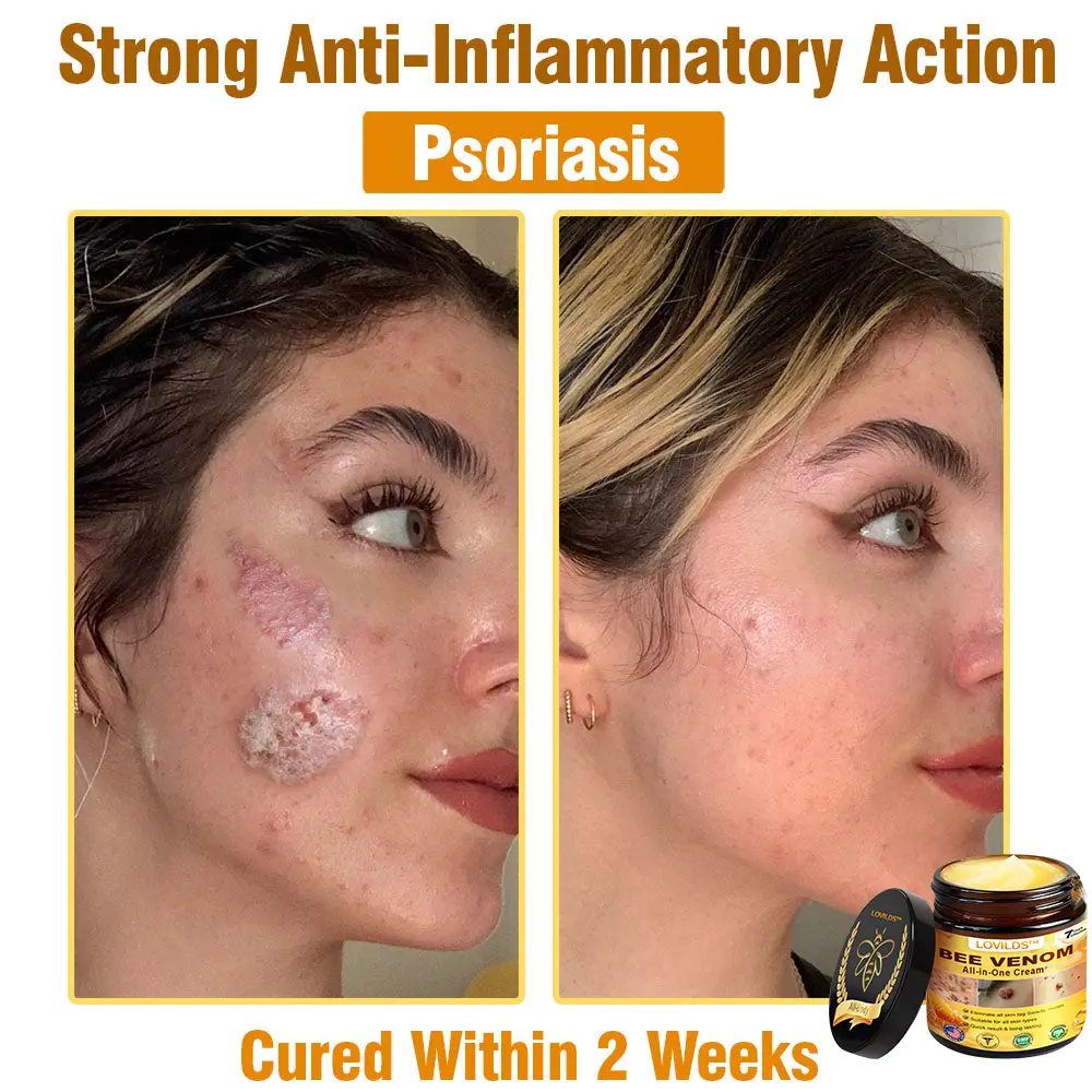 Bee Venom Cream – Anti-Aging Hydrating & Skin Repair - Image 16