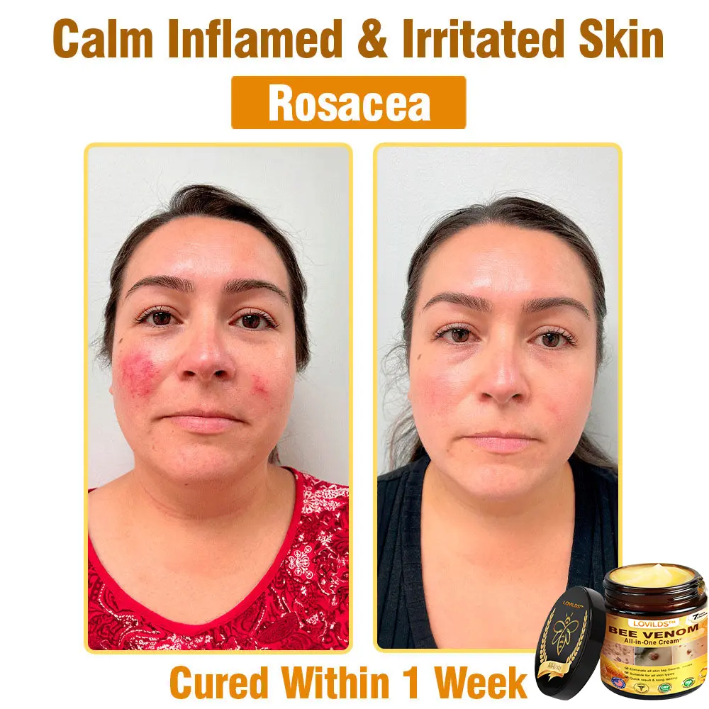 Bee Venom Cream – Anti-Aging Hydrating & Skin Repair - Image 17
