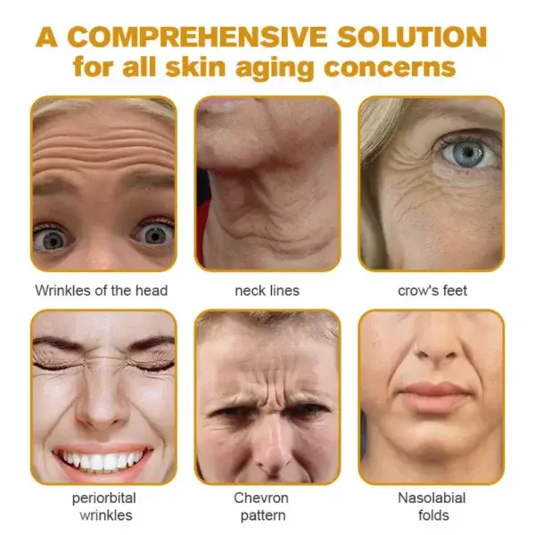 Botox Bee Venom Wrinkle Removal Cream - Image 6