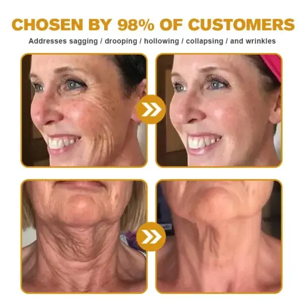 Botox Bee Venom Wrinkle Removal Cream - Image 7