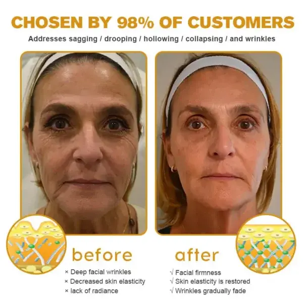 Botox Bee Venom Wrinkle Removal Cream - Image 8