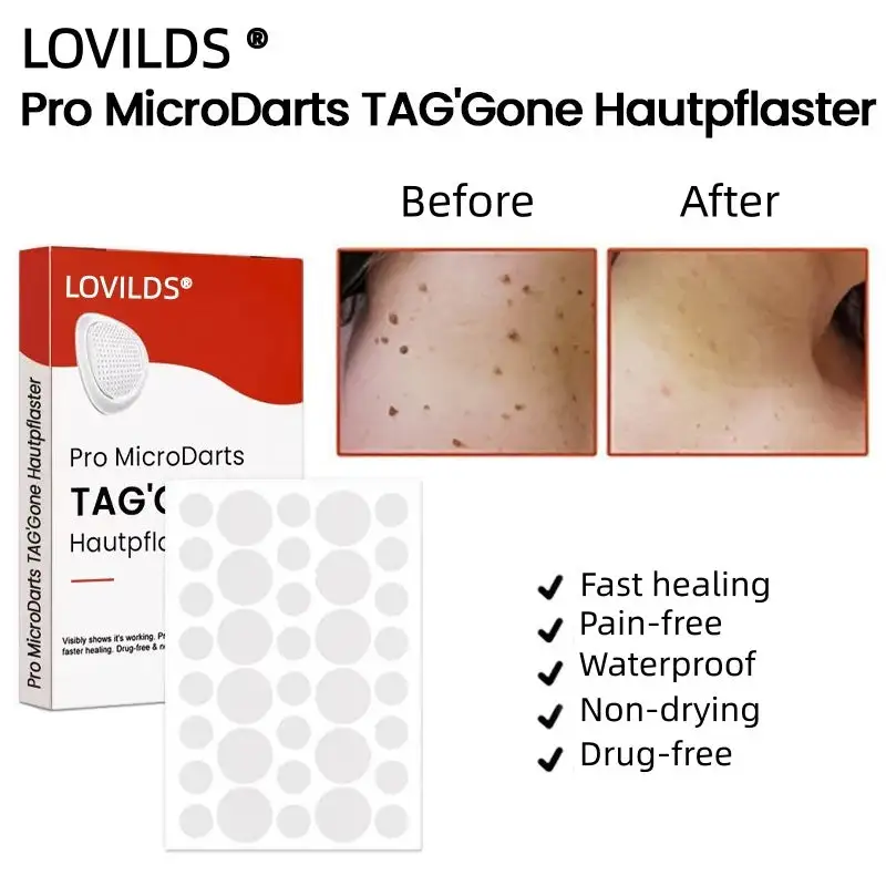 Pro MicroDarts TAG'Gone Skin Tag Removal Patch - Image 2
