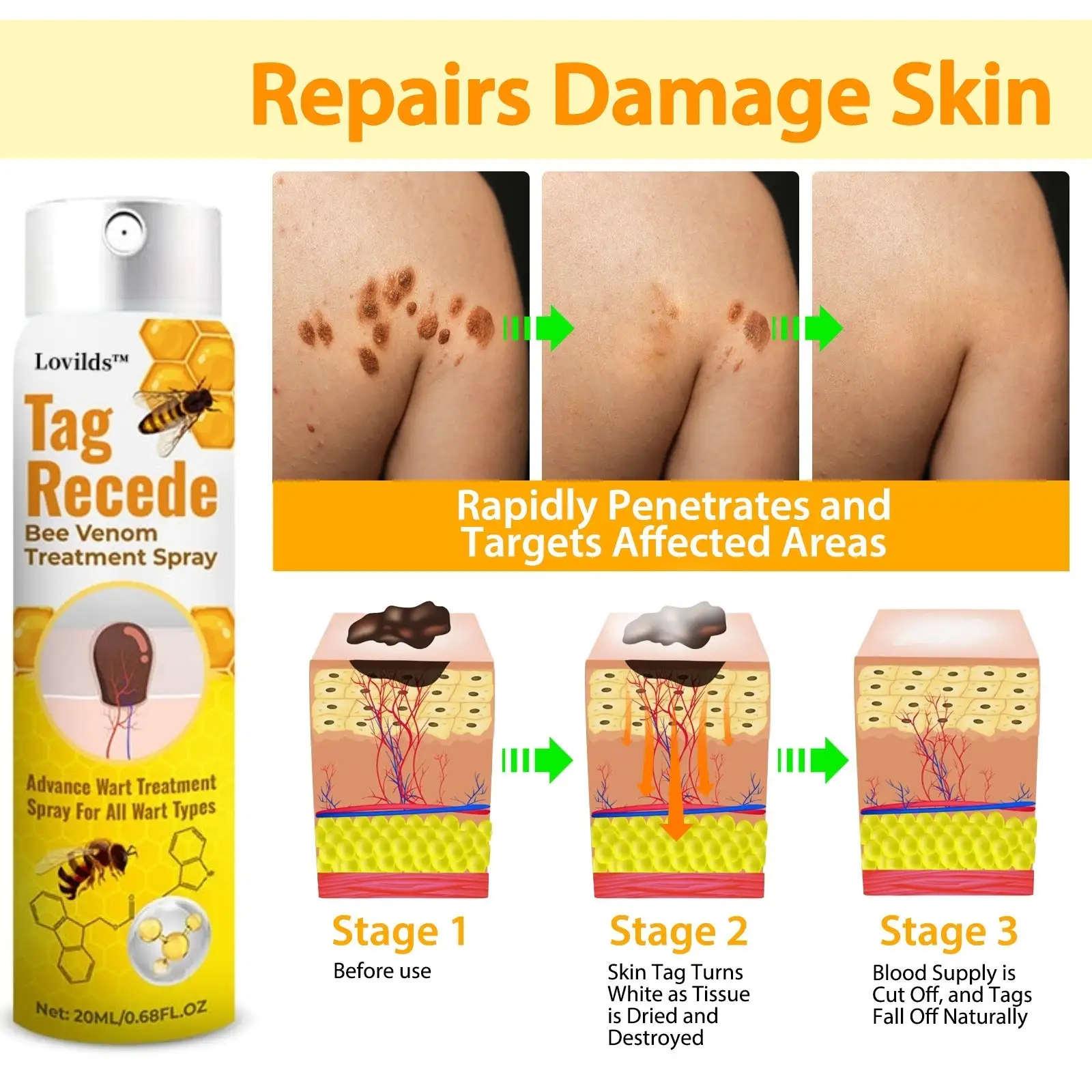 TagRecede Bee Venom Treatment Spray - Image 3