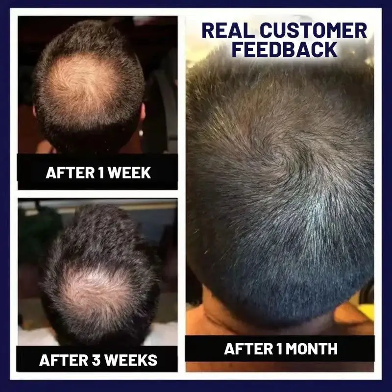LOVILDS Natural Hair Regrowth Spray - Image 4