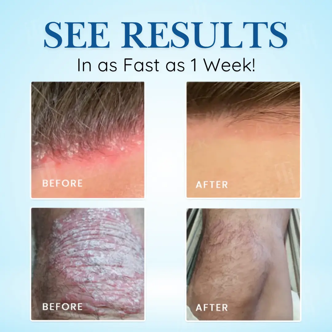 Source-Relief Magnesium Spray - Image 2