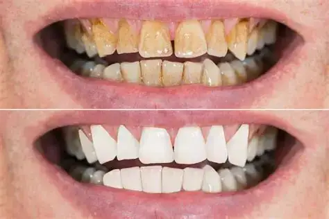 Advanced Dental Care Toothpaste - Image 5