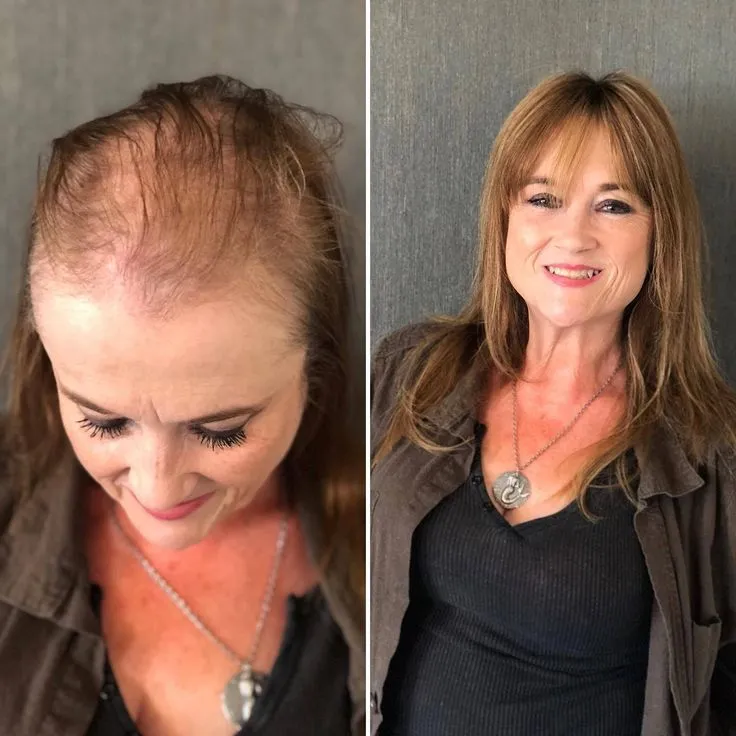 Hair Restoration Spray - Image 5