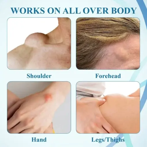 LumpsClear Lymph Say Goodbye to Lipomas and Swelling - Image 10