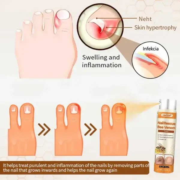 NailRescue Včelí jed ve spreji - Image 4