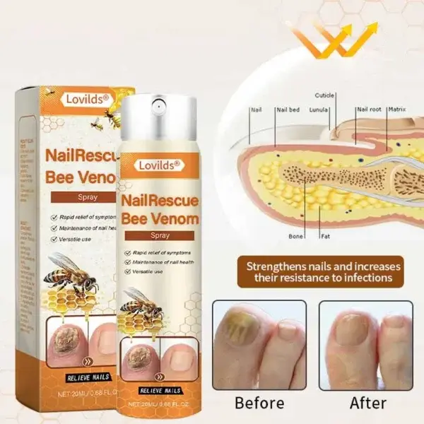 NailRescue Včelí jed ve spreji - Image 5