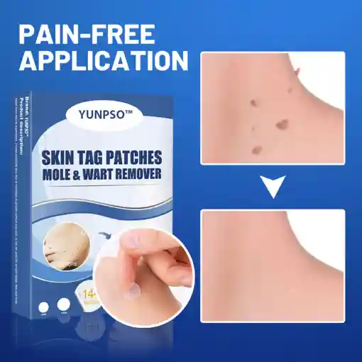 Moles & Warts Removing Skin Tag Patch