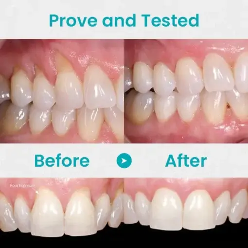 Gum Shield Therapy Gel - Image 9