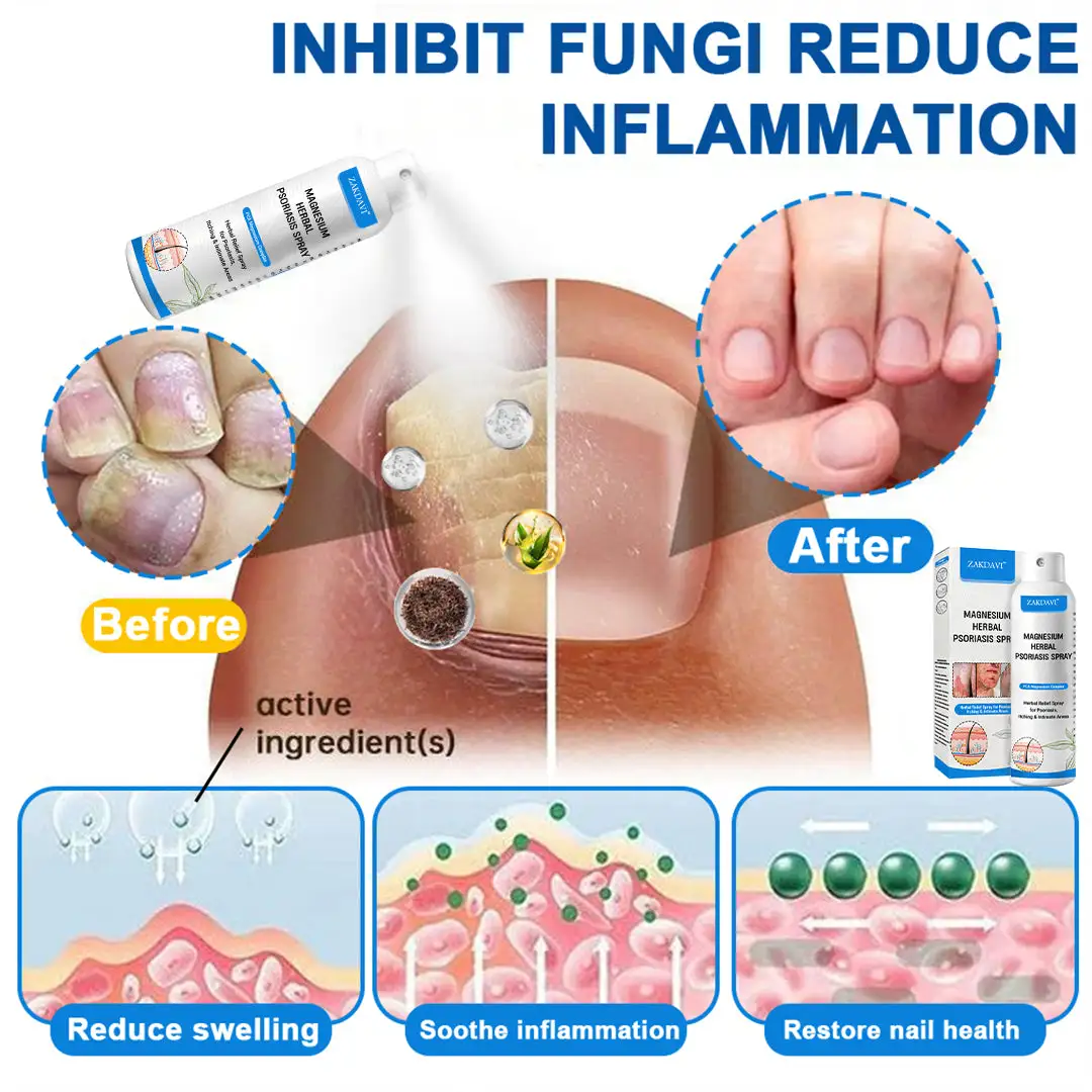 Magnesium Herbal Psoriasis Spray - Image 10