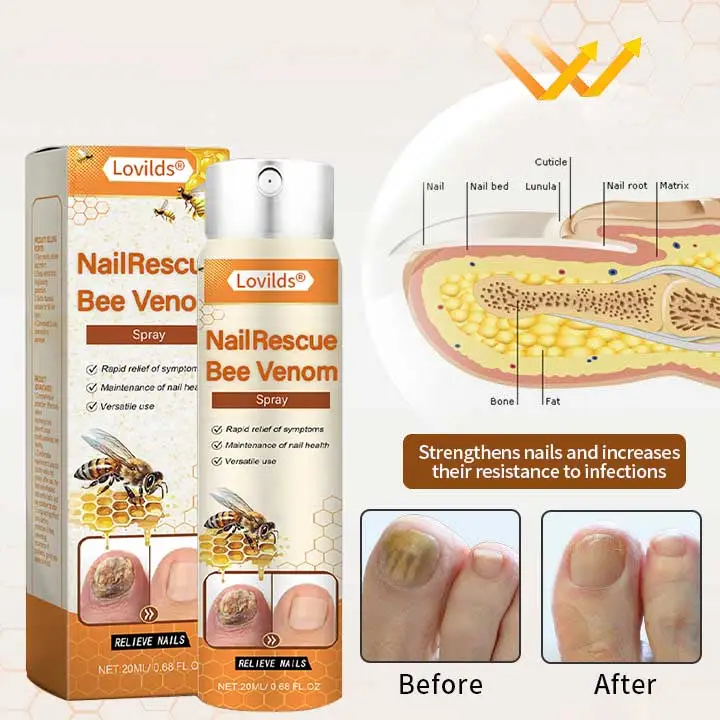 NailRescue Včelí jed ve spreji - Image 5