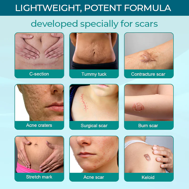 Medical Scar Removal Spray - Image 4