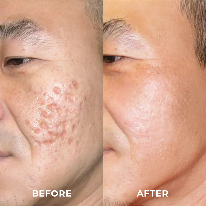 Medical Scar Removal Spray - Image 7