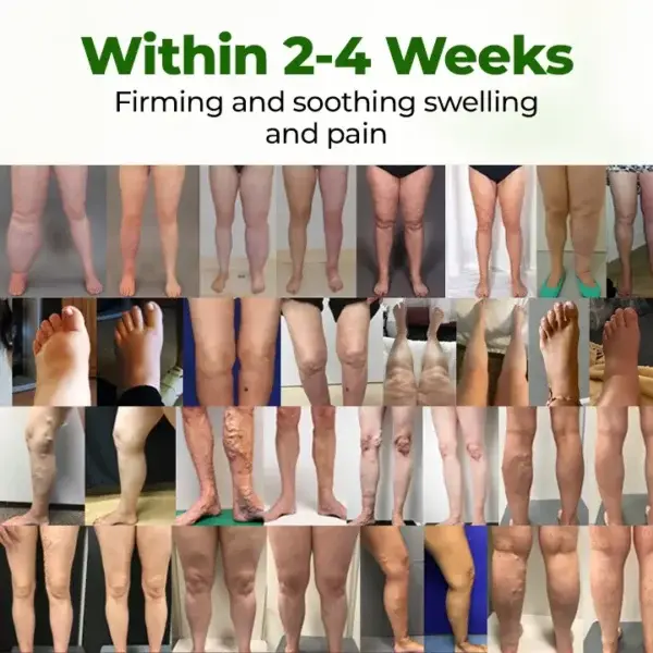 Professional Leg Circulation Cream