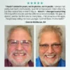 Premium Custom Dentures