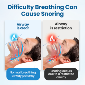 SnoreLess Nasal Breather