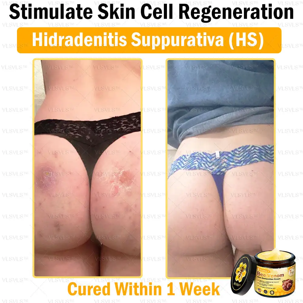 Special Sale Bee Venom Skin Restoration Cream - Image 11