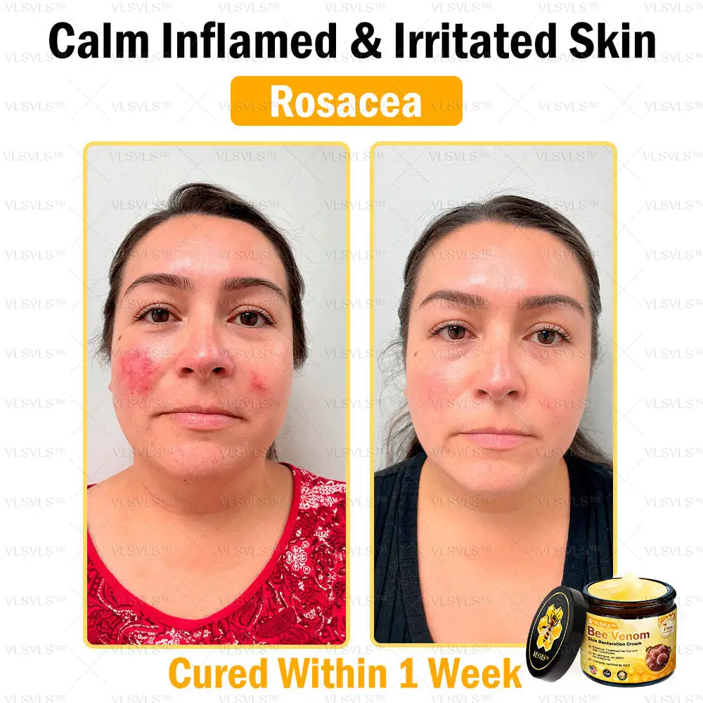 Special Sale Bee Venom Skin Restoration Cream - Image 5