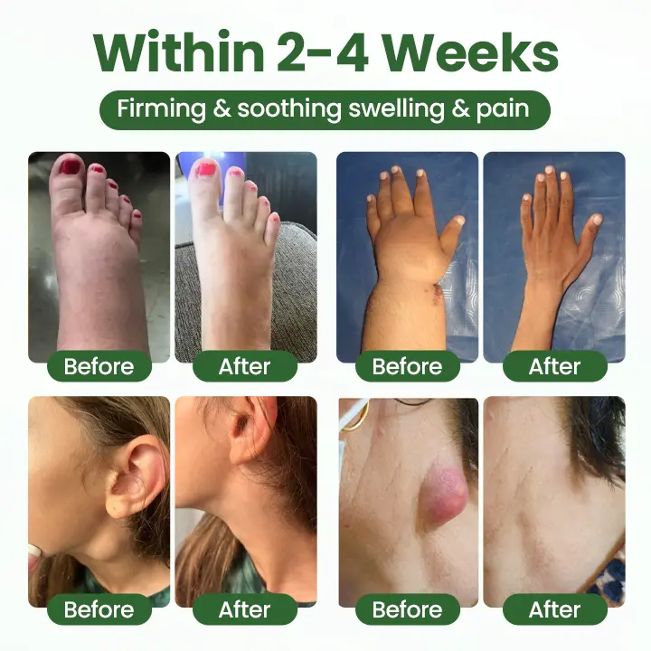 BodyRelief Circulation Cream - Image 2