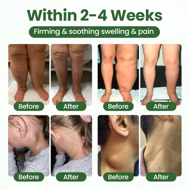 BodyRelief Circulation Cream - Image 3