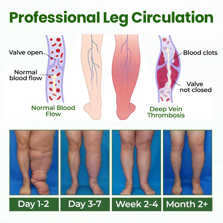 BodyRelief Circulation Cream - Image 6