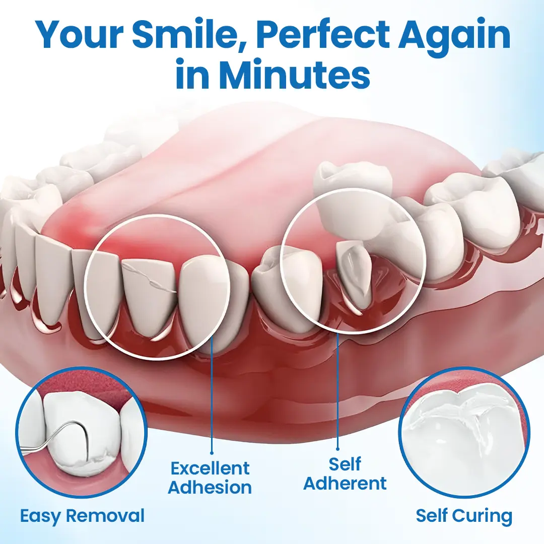 SmileMend Tooth Repair Filling Kit - Image 7