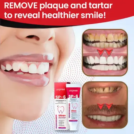 SP-6 Ultra+ Probiotic Whitening Toothpaste - Image 10