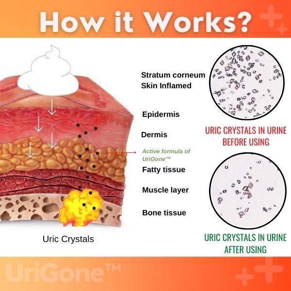 Healing Ointment for Gout - Image 3