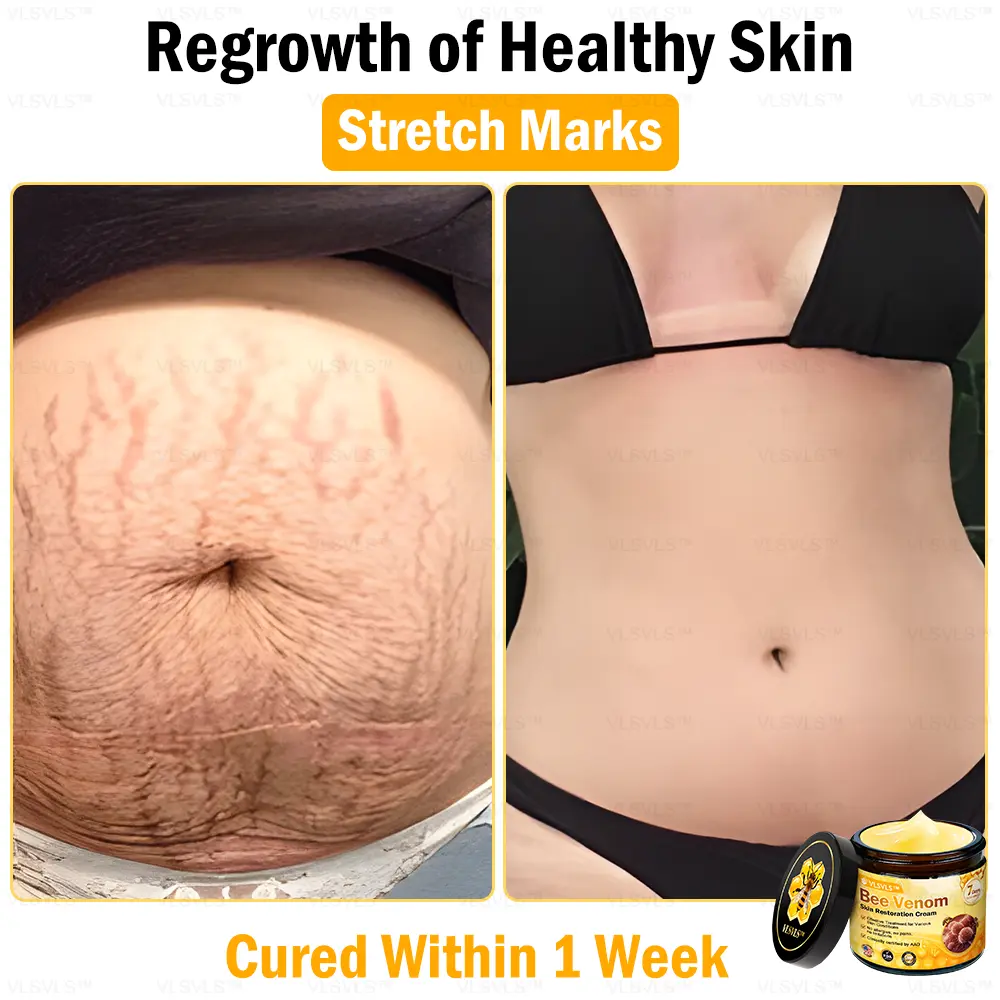 Bee Venom Skin Restoration Cream - Image 10