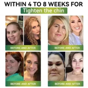 Weight Loss Oral Solution
