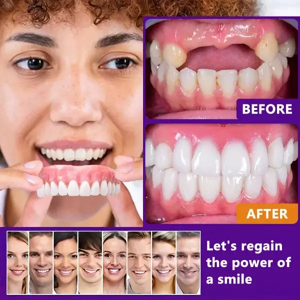 Advanced Customized Full Denture Set - Image 12