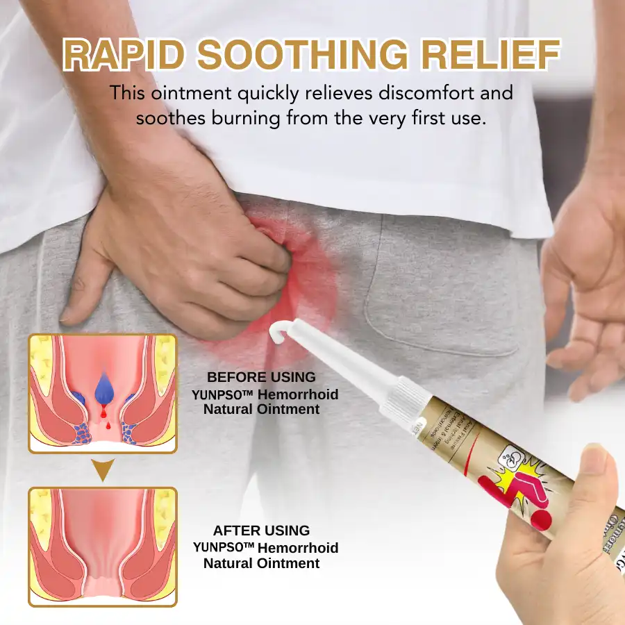 Hemorrhoid Natural Ointment - Image 3
