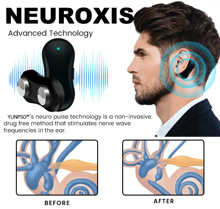 Tinnitus Relief Device Serenity - Image 8