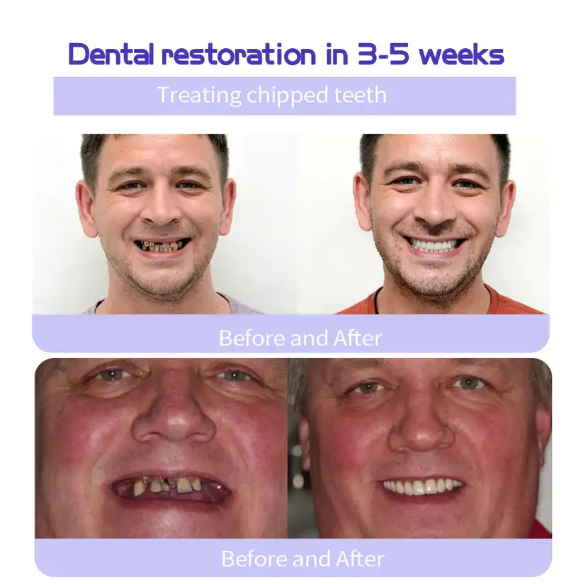 Teeth Restoration Mineral Powder - Image 5