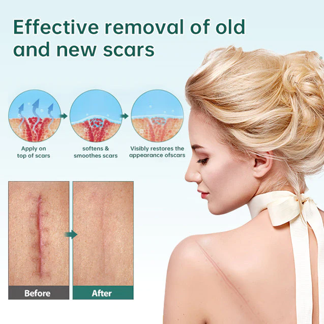 Natural Scar Removal Spray - Image 4