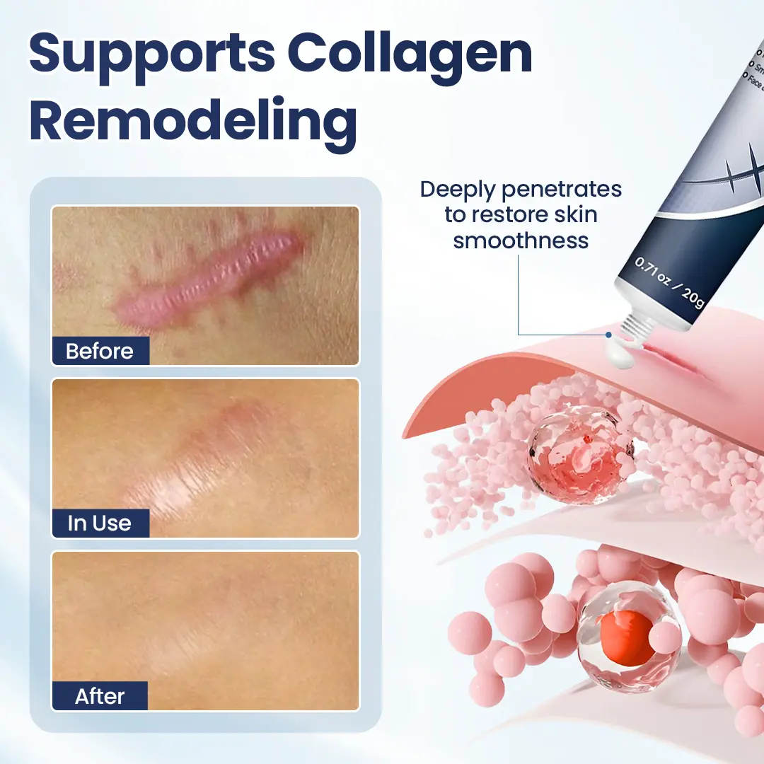 DermaFix Texture Repair Gel - Image 3