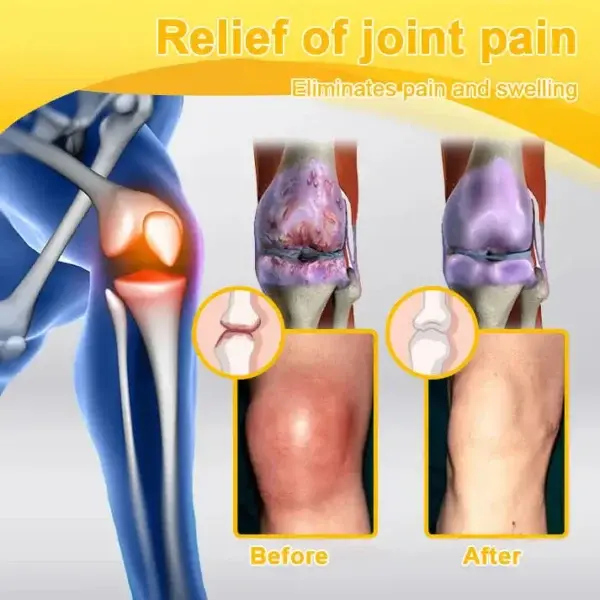 Botulinum Toxin & Bee Venom Orthopedic Relief Cream - Image 9