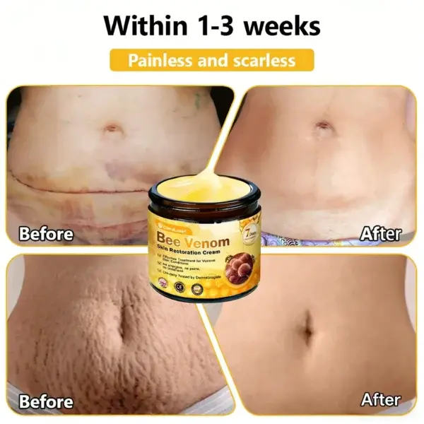 Bee Venom Skin Restoration Cream - Image 10
