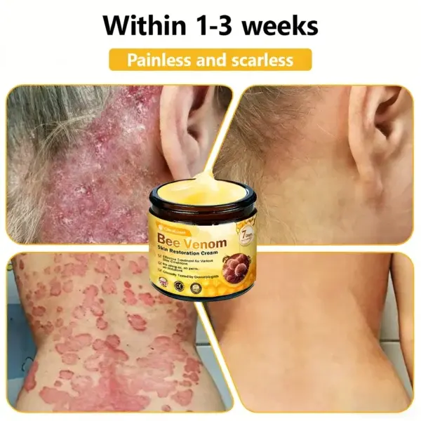Bee Venom Skin Restoration Cream - Image 7