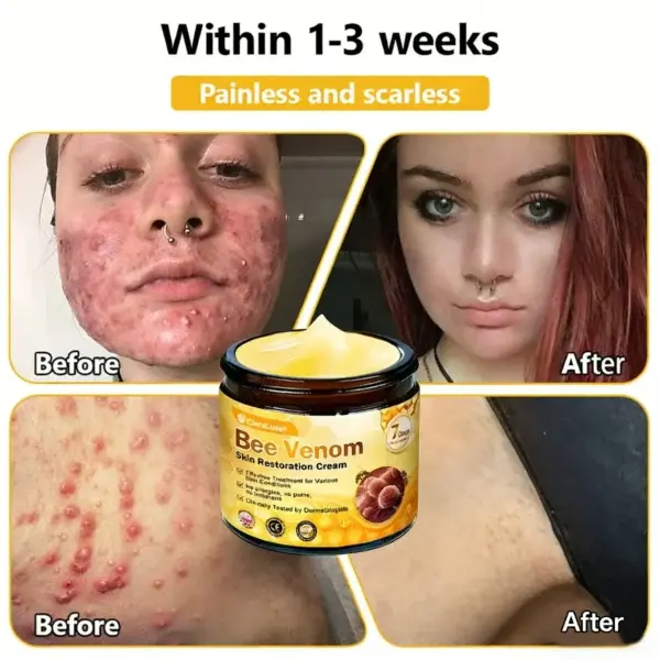 Bee Venom Skin Restoration Cream - Image 9