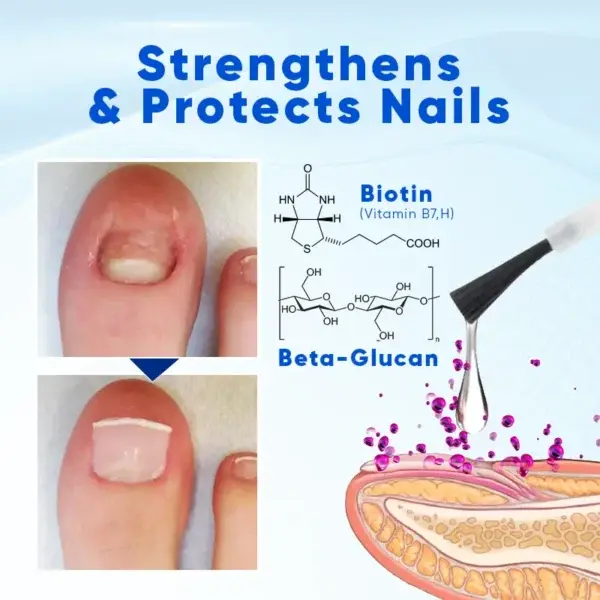 NailRebuild Nail Growth and Repair Serum+ - Image 6